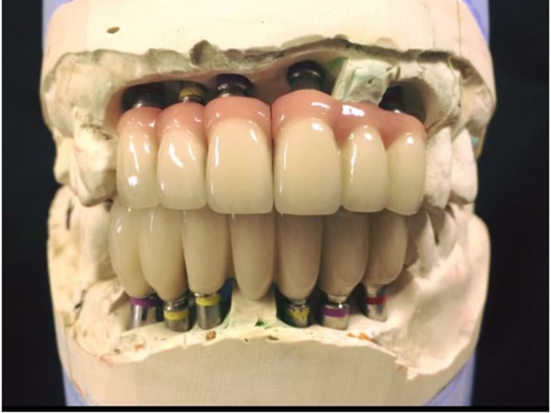 content-image for Foothill Dental Lab
