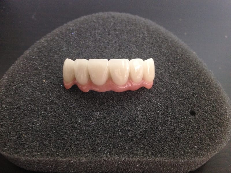 content-image for Foothill Dental Lab